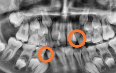 Mitos y realidades sobre la odontología